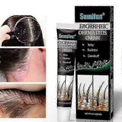 Psoriaattisen seborrooisen dermatiitin hoito kerma pää akne kutina päänahka silsa korjata iho puhdistusvoide hiukset päänahan hoito 1pc