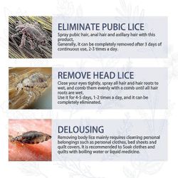 Luonnolliset täit ja syyhy poistosuihke - antibakteerinen ja kutinaa ehkäisevä päänahan hoito 3PCS