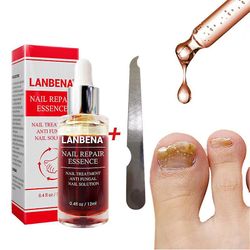 Lanbena Svampe negle Reparation Serumpleje Behandling Fod neglesvamp fjernelse gel Anti Paronychia onychomycosis