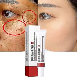 3pcs Effektiv Bleking Fregne Krem Fjern Melasma Akne Spot Pigment Melanin Mørke flekker