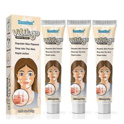 3stk Vitiligo fjerning krem vitiligo rensing krem ansiktspleie salve hudpleie hudpleie