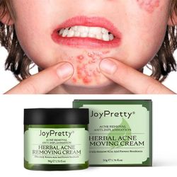 Kuankuanbao Joypretty Teepuun aknevoide haalistuu Akne Print Herbal Acne Cream A