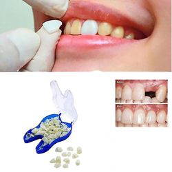 Phwj Väliaikainen hampaiden korjaussarja hampaat ja aukot hampaiden valkaisu hampaiden hampaiden selkähampaat
