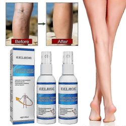 2025 Veinfix suonikohjujen hoitosuihke suonikohjujen hoitosuihke Intravenous Massage Spray