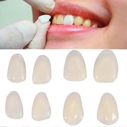 70kpl/pussi Hampaiden viilut Hartsi Anterior Upper Temporary Crown hammashoitoon