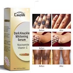 Zdiqing New Joint Finger Black Skin Beauty Knee Kyynärpää Kainalo Melanin 30ml Valkoinen