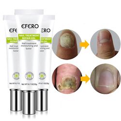 3 stk Fungal Nail Treatment Serum Nail Foot Nail sopp fjerning Gel Anti infeksjon