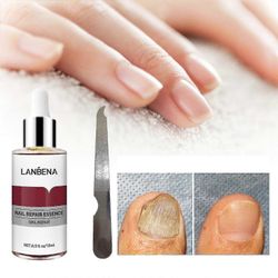 Lanbena Kynsien korjaus Essence Kirkas kynsi pienellä viilalla