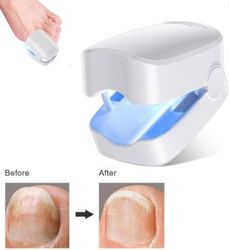 Kynsien lasersienen hoitolaite, kynsien ja varpaankynsien lasersienipuhdistuslaite, kynsien sienen laserhoito valkoinen
