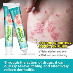 Boris Psoriasis Krem Hud Moss Fjerning Krem Pityriasis Versicolor Sweat Spots Hud Kløe Krem