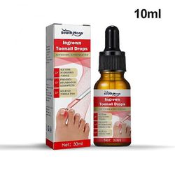 Sisäänkasvanut varpaankynsihoito seerumi kynsien korjaus palauta öljykipu lievittää sisäänkasvaneiden varpaankynsien korjausta 10 ml
