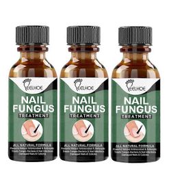 Erittäin jyrkkä nagelsvampbehandling, bsta nagelreparation stoppa svamptillvxt Effectiv 3pcs
