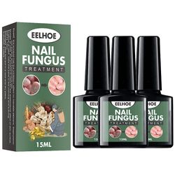 Antifungal behandlingsserum for negler, hånd og føtter, reparasjon frost, antiinfeksjon, paronychia, spesialtilbud 3Pcs Nail Polish