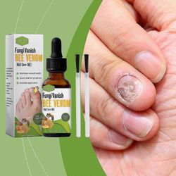 Kynsien kasvu- ja korjausseerumi, erittäin luja kynsien korjausratkaisu, Bee Venom -kynsienhoitoöljy ohuille kynsille, hauraille ja vaurioituneille...