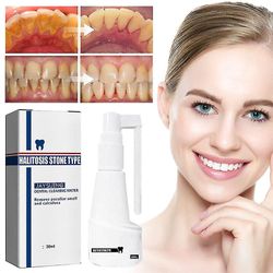 30ml Laskenta liuottava hammassuihke Suuhampaiden puhdistus hammaspuhdistusaine Tartar Remover