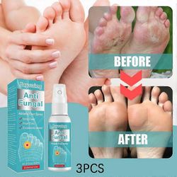 1kpl urheilijan jalkasuihke, haisevat jalat, kutiavat jalat, hikinen haju, mätä jalat, kutinaa estävä urheilijan jalkasuihke 3PCS