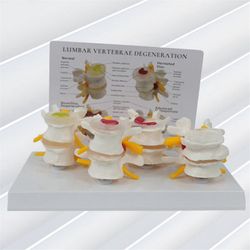 Nelivaiheinen nikamamalli, ihmisen anatomia ja fysiologia Koulutuksellinen selkärankamalli, lääkärin vastaanotto kuten kuvassa näkyy