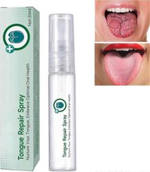 Kielen korjaussuihke, suun hajunpoistaja kuivuuteen ja pahanhajuiseen hengitykseen, halkeileva kielen helpotussuihke, välitön suun kuivumisen helpo...