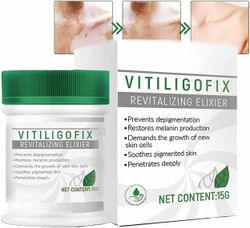 Vitiligo Fix Revitalize Elixir, vitiligo Behandling Cream, behandle Vitiligo beroligende creme, psoriasis Relief Cream, krop Vitiligo Care Cream, f...