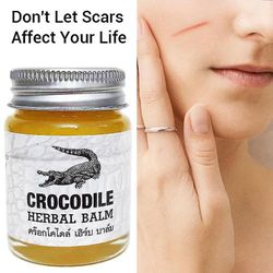 Crocodile Scars Elimination Cream, Thai Plant Balm, Blegning Af Acne Brands, Kvalificeret Ration Af Ar, Kontrolleret Pigmentering, Cre Q6c4