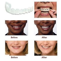 Ett par övre och lägre högkvalitativ protes Instant Smile Comfort Passar Flex Kosmetiska tänder Tandprotes tänder Topp Kosmetisk faner Hög kvalitet