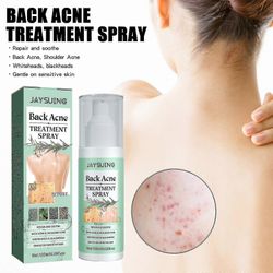 Jaysuing Back Acne Repair Spray häivyttää aknen jälkiä, korjaa selkää, hartioita ja vartaloa, puhdistaa ja tasoittaa ihoa BF -8415342915523