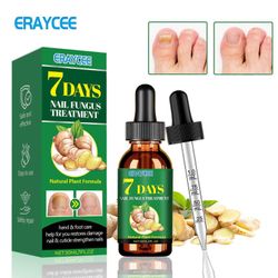 7 päivän kynsien kasvuseerumi, 7 päivän inkiväärikynsien esanssi, monikäyttöinen kynsien korjaus, kynsien ravinneöljyn vahvistajaöljy 3pcs