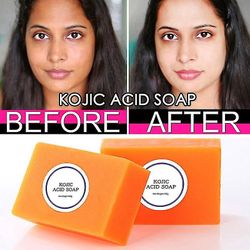 Kojic Acid Whitening Såpe Mørk Svart Hud Lightening Såpe Kojic Acid