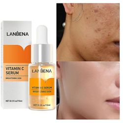 Qian C-vitamin kridtning Ansigt Serum Lighten Pletter lysere Facial Skin Essence Fade Mørke pletter Fjern Fregne Speckle Care