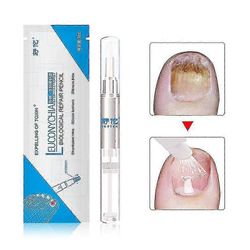 3ml sienihoito kynsiöljykynä sieniä estävä kynsinauhojen poistoaine