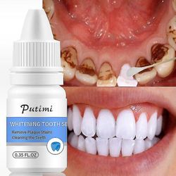 Tandblegning Essence Mundhygiejne Kridtning Gel Fjern Plak og pletter rengøring og blegning tænder