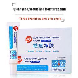 Blemish Removal Cream Anti-Akne Pimples Nature Yrtti Turvallinen Aknen poistovoide Uusi