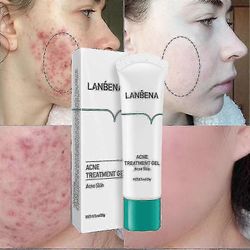 Hua Poistovoide Anti- Fade S Pimples L Kutistuvat huokoset Kasvojen hoito