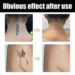 Peitä peitä meikkipeitevoide tummille läiskille Vitiligo ja muut väritSet pu2216 A