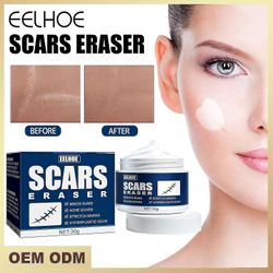 Eelhoe Cream Skin L Cream Burn Cream Fade Kirurgisk Rep Cream 30g