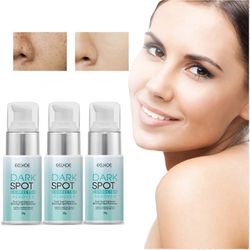 3kpl 2023 UUSI tumman pisteen korjaimen poistoaine kasvojen valkaisu ryppyjä estävä kirkastava voide