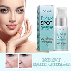 Anti Dark Spot Remover Skin Whitening Face Freckle Removal Aging Blemishes Cream