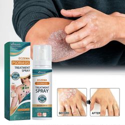 Eczema Psoriasis Treatment Spray, Herbal Psoriasis Relief Spray Eczema Relief Spray Vitiligo Psoriasis Treatment Relief Spray Skin Repair Spray 2pcs