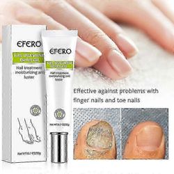 UUSI efero kynsivoide 20g kynsien korjausvoide