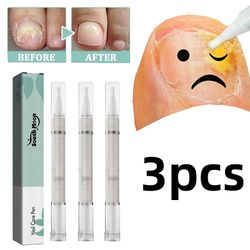 3pcs Gesundheitroutinenail Care Pen kosmetische Nagelpilzbehandlung schnell intensiv fr Ngel mit Aloe Vera