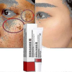 Kerma melasman ja melaniinin poistamiseksi - 2023 Changzhaon ihonhoito - S- ja L-koot Tw 1 kpl