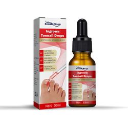 30ML sisäänkasvanut varpaankynsihoito, kynsien kasvuhoito, sisäänkasvanut varpaankynsi tippaa kynsinauhojen kynsiöljyä sisäänkasvanut varpaankynsie...