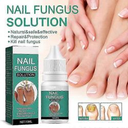 Kynsisienihoito varpaankynsille Erittäin vahva, sisäänkasvanut varpaankynsien hoito Kynsienhoitoöljyt, varpaankynsien sienihoito 3 kpl