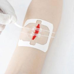 Vetoketjunauha kivuttomaan haavan sulkemiseen - ompelemattomat sidoslaastarit, vetoketjuompeleiden vähennysventtiili, nauhatuki nopeaan paranemiseen A