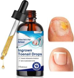 Sisäänkasvaneet varpaankynsipisarat, sisäänkasvanut varpaankynsien hoito, kynsinauhojen hoitoöljy sisäänkasvaneille varpaankynsille, erittäin luja ...