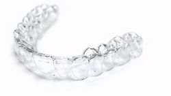 4 kpl sarja hampaiden valkaisuun/geelivalkaisuun, lämpömuovaukseen