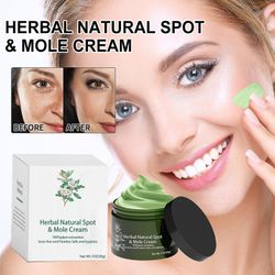 unbrand Whitening Cream, krem mot hvite flekker, AntiFreckle Whitening Cream, fuktighetskrem corrector for mørke flekker på ansiktet 30g kremer og ...