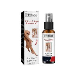 Vitiligon poistosuihke kosteuttaa parantaa pigmentaatiota Leukoplakia Melaniinia estävä melaniini Poista silsa Lamppu Valkoiset täplät Hoitosuihke ...