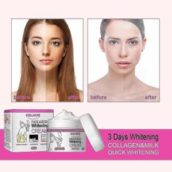 Eelhoe Cream Hydrating nærende Lot Ening Melanin hudpleie krem 50g