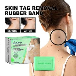 Skin Wart Eliminator saippuat, Syylänpoistosaippua, Instant Blemish